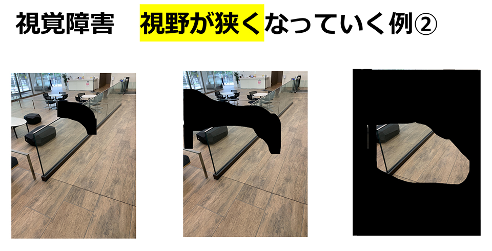 視覚障害　視野が狭くなっていく例の画像