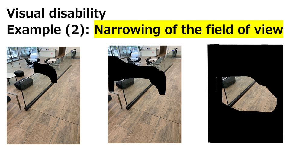 Visual disability Example(2): Narrowing of the field of view